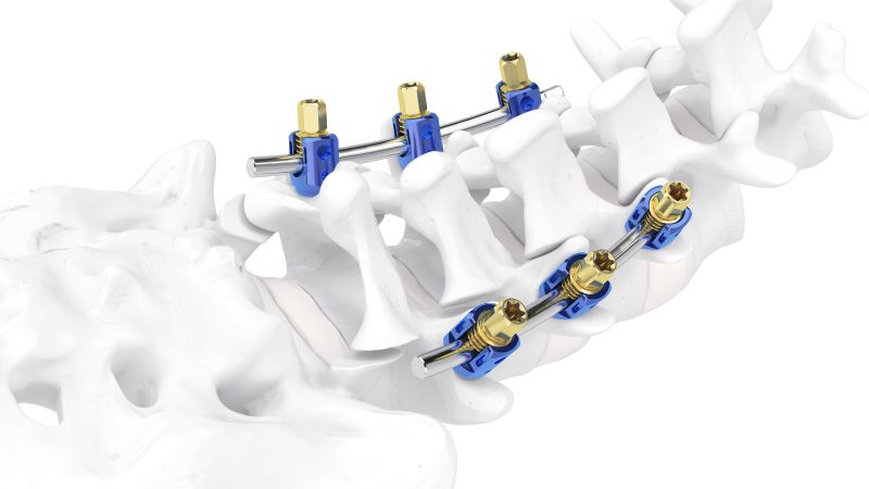 Kangui Medtronic Travma Setleri